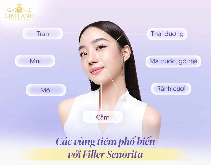 Filler Senorita giữ được bao lâu