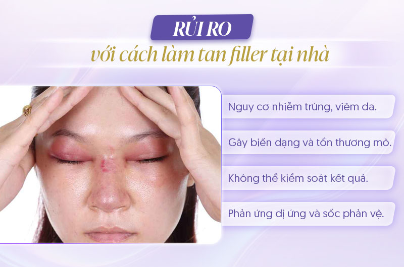 Hậu quả khi làm tan filler tại nhà