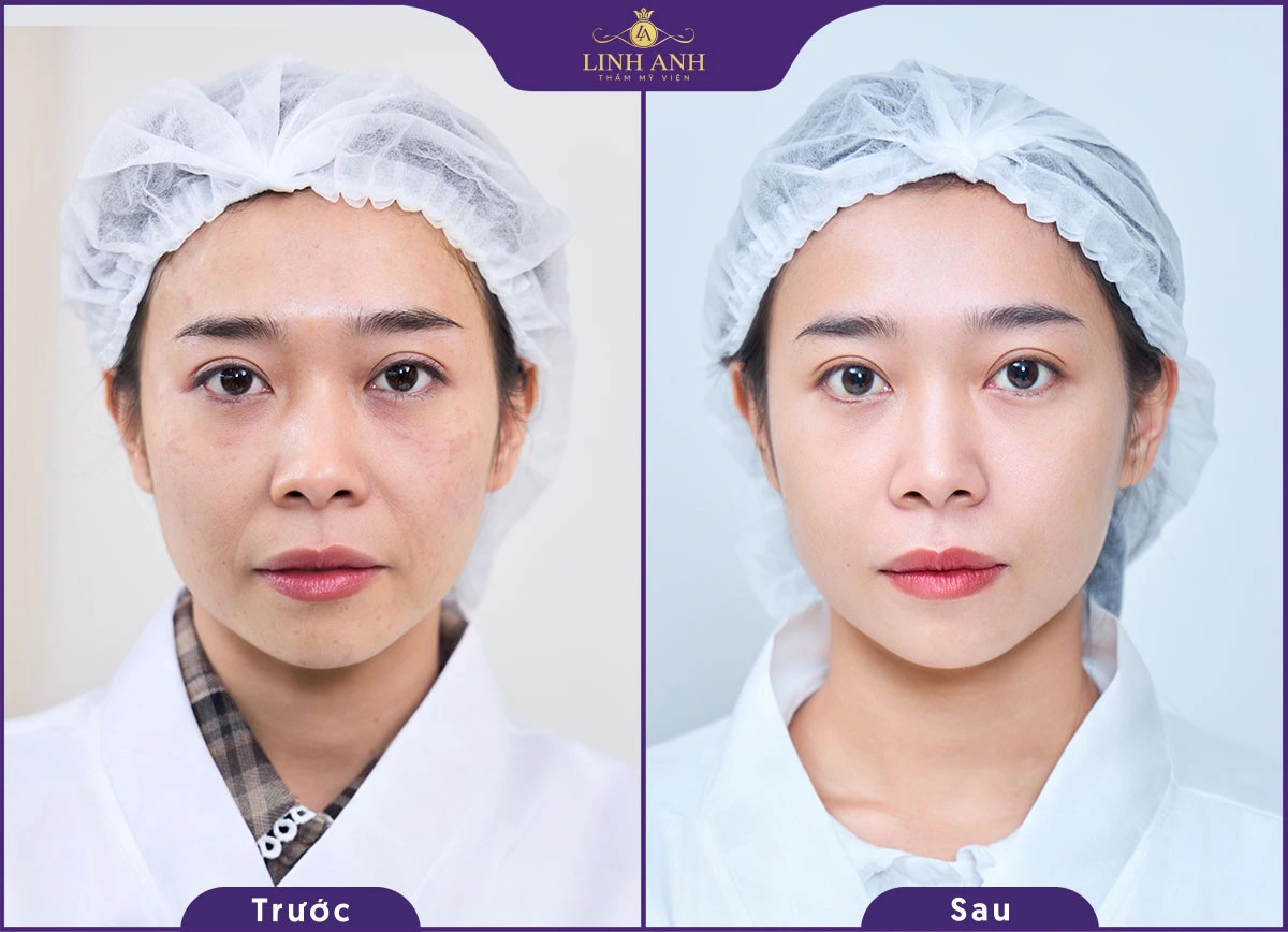 khach hang nguyen thao