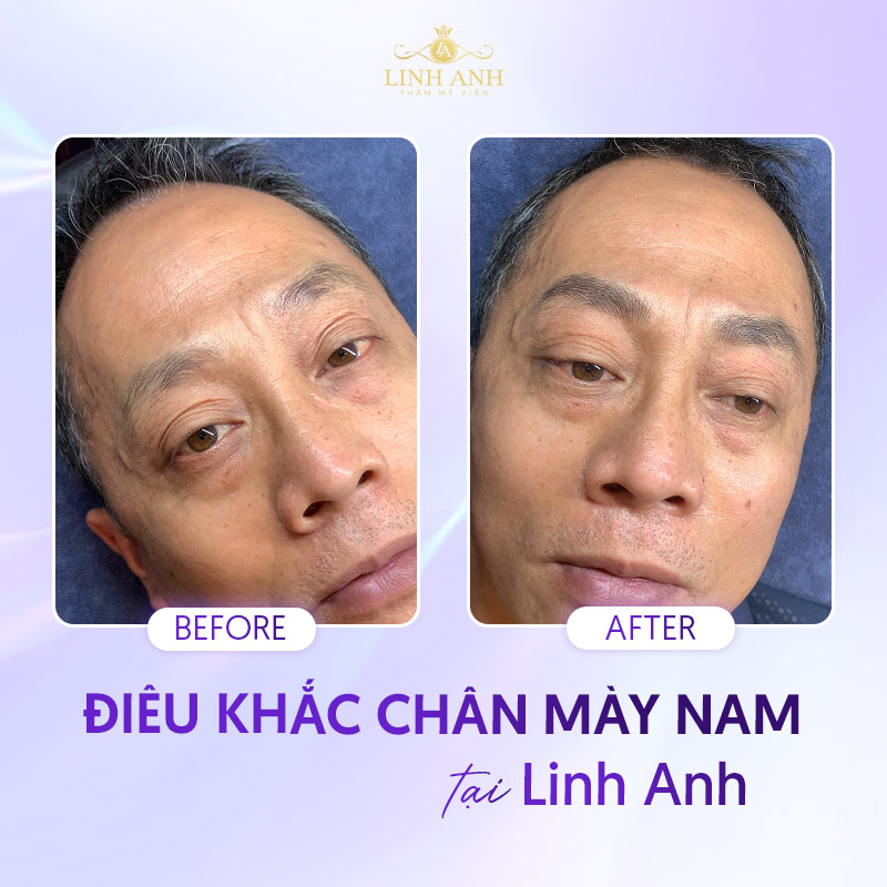 kiểu lông mày nam đẹp thịnh hành nhất