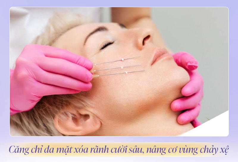 Làm đầy rãnh cười