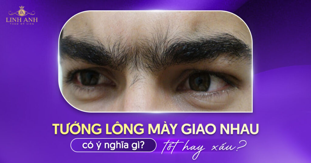 lông mày giao nhau