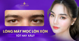 lông mày mọc lộn xộn