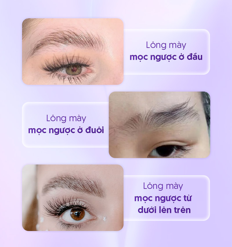 lông mày mọc ngược ở nam và nữ