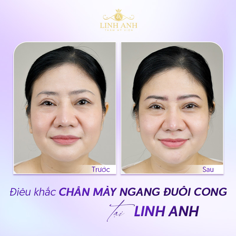 lông mày thẳng