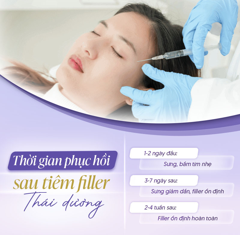 Lưu ý sau khi tiêm filler thái dương