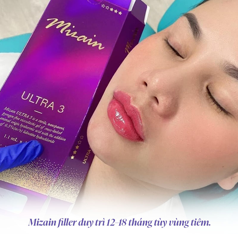 Mizain filler giữ được bao lâu
