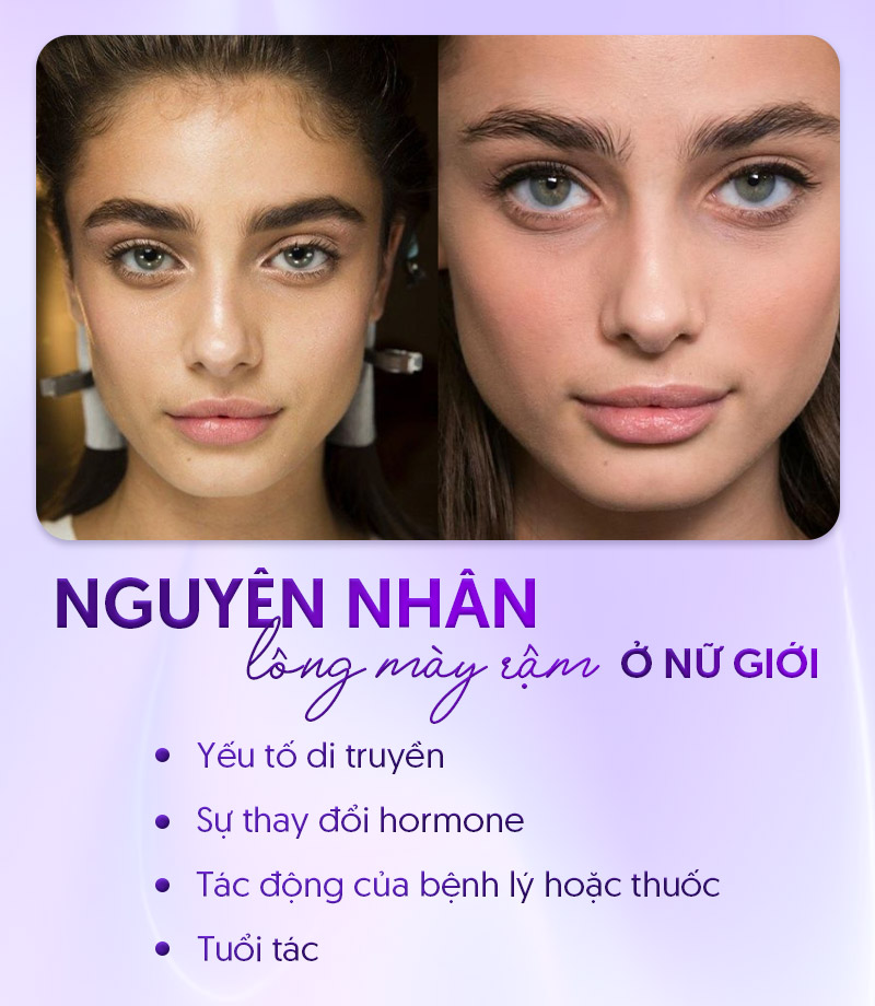 nguyên nhân khiến lông mày rậm