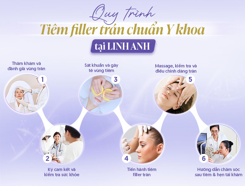 Quy trình Tiêm filler vùng trán