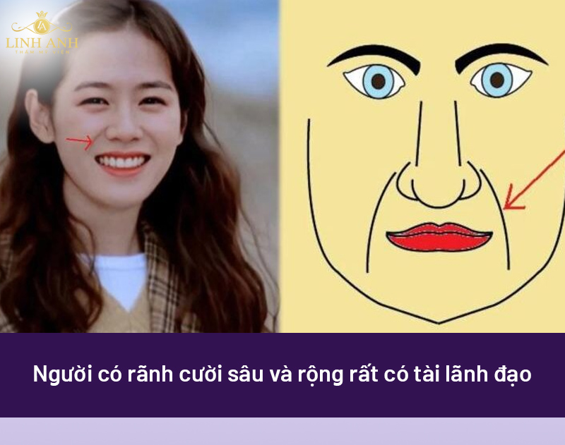 Rãnh cười sâu phong thủy