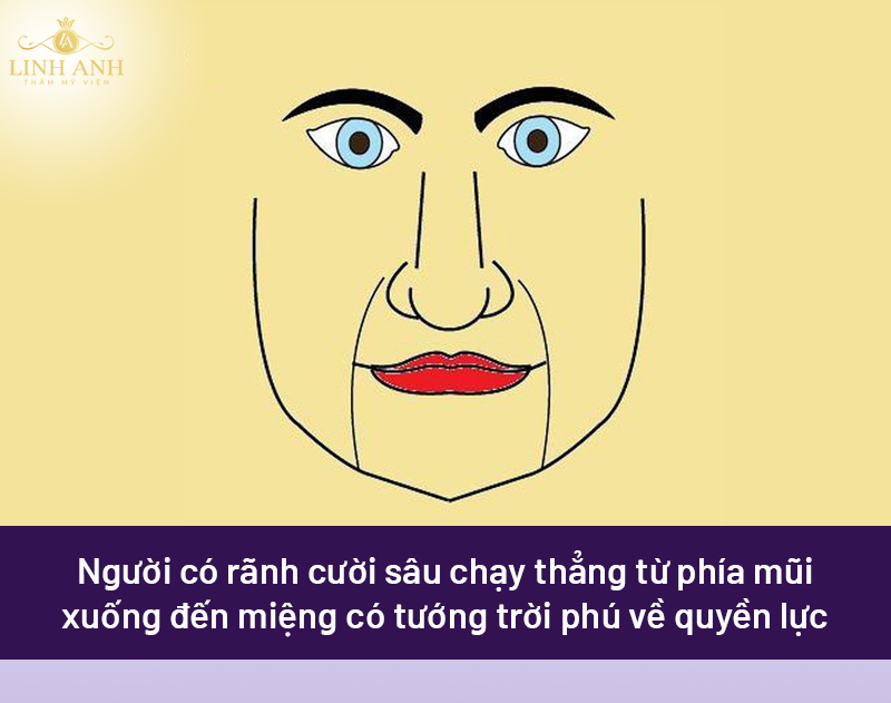 Rãnh cười sâu dài xuống cằm và không chạm vào khóe miệng