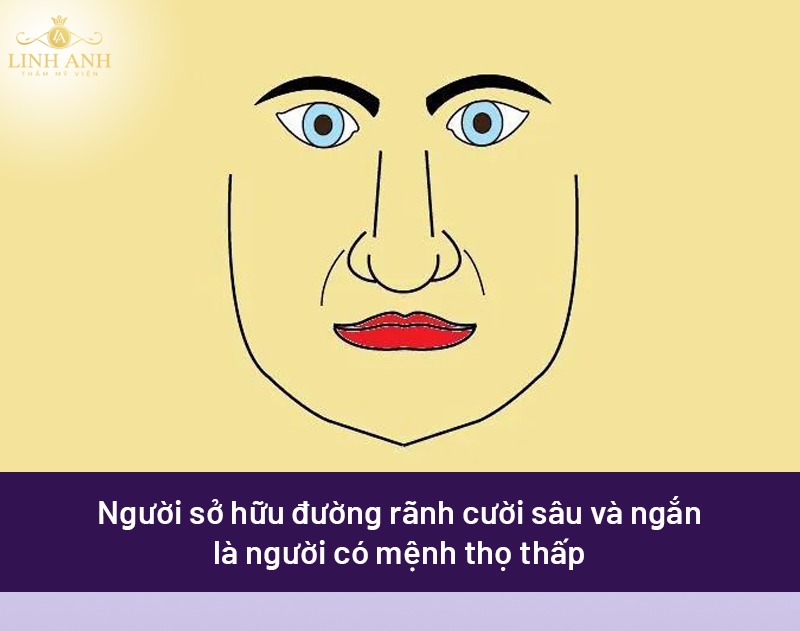 Rãnh cười sâu và rộng