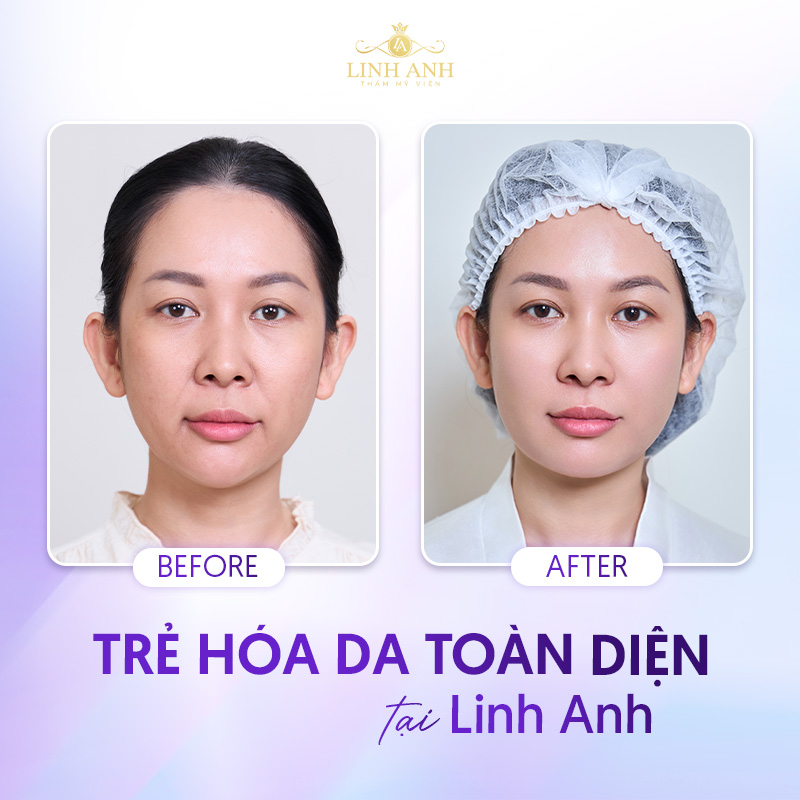 thẩm mỹ viện uy tín tại tp hcm