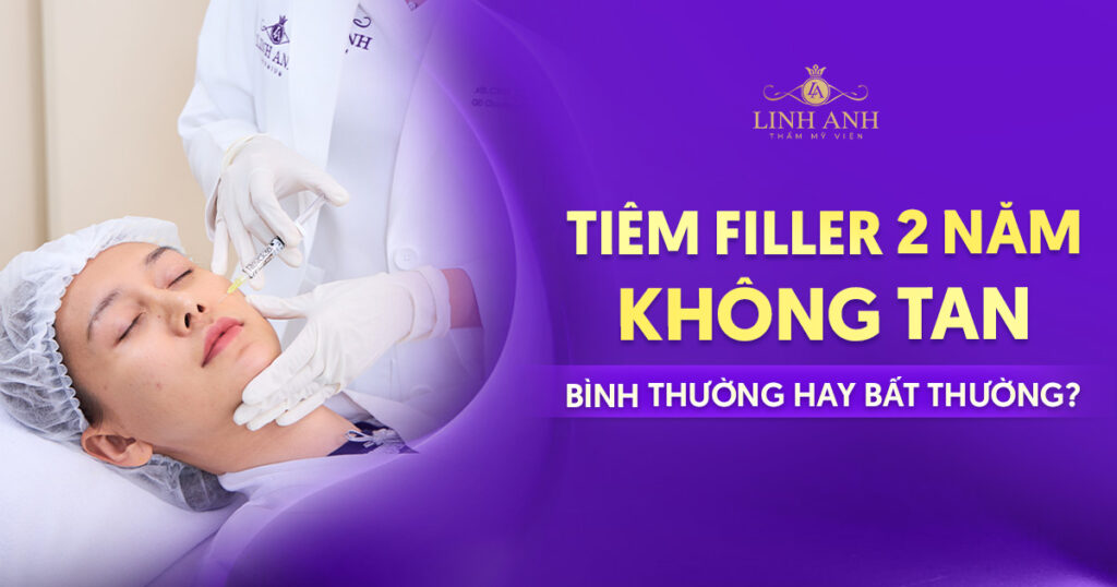 Tiêm filler 2 năm không tan