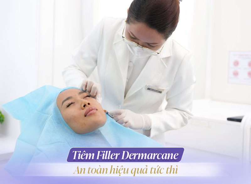 Tiêm Filler Dermarcane