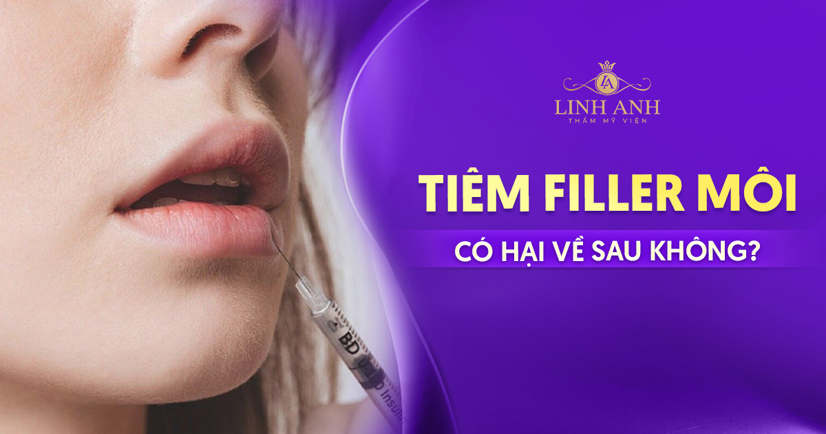 Tiêm filler môi có hại về sau không? Bác sĩ chỉ ra sự thật bất ngờ