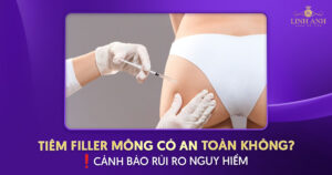 Tiêm filler mông