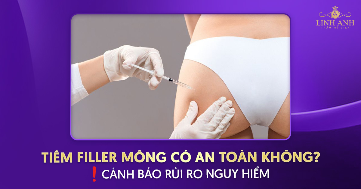 Tiêm filler mông