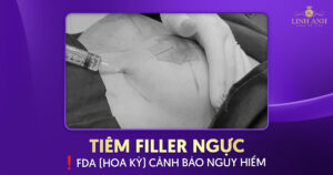 Tiêm filler ngực