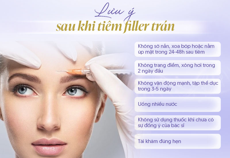Tiêm filler trán cần lưu ý gì