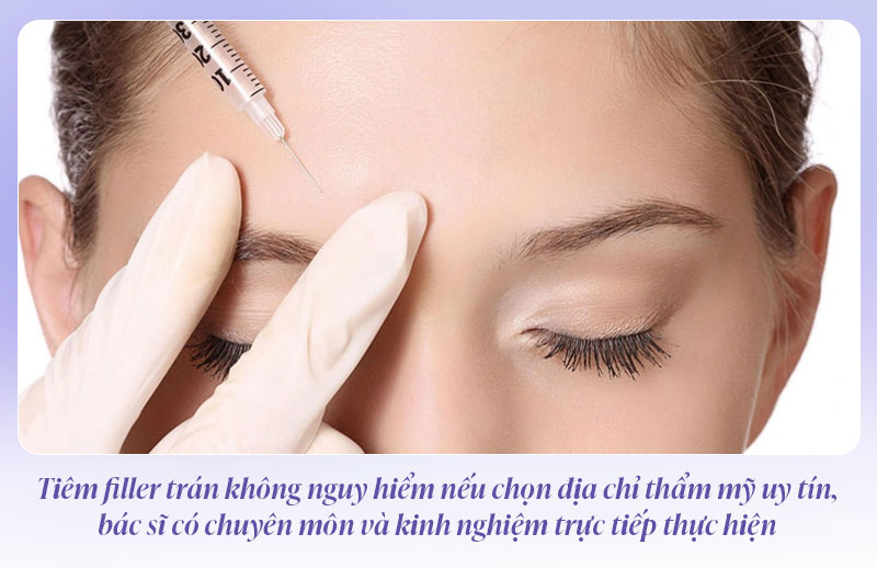 Tiêm filler trán có nguy hiểm không