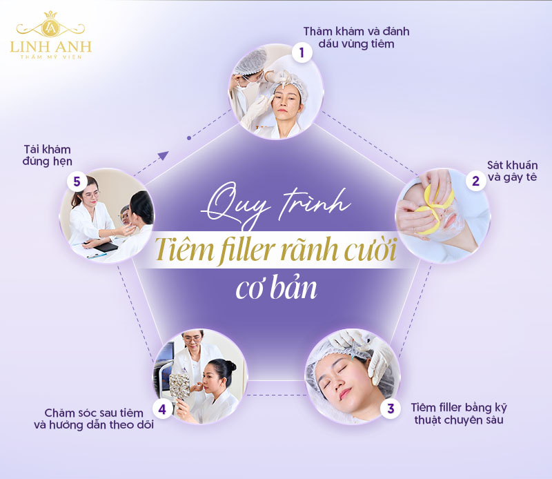 Tiêm rãnh cười bao lâu thì đẹp