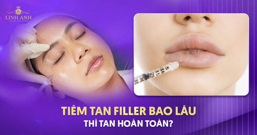 Tiêm tan filler bao lâu thì tan