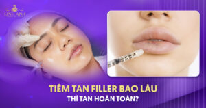 Tiêm tan filler bao lâu thì tan