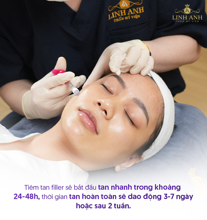 Tiêm tan filler bao lâu thì tan hết