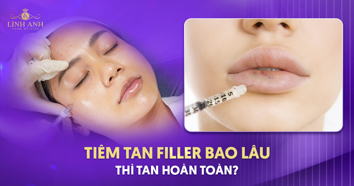 Tiêm tan filler bao lâu thì tan? Thời gian tác dụng của thuốc tan