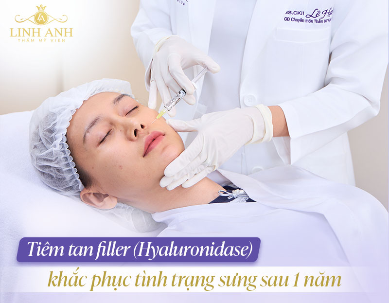 Tiêm tan filler bị sưng sau 1 năm