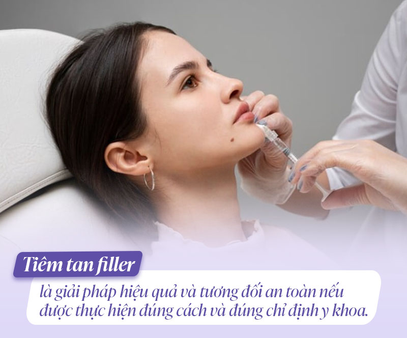 Tiêm tan filler có an toàn không