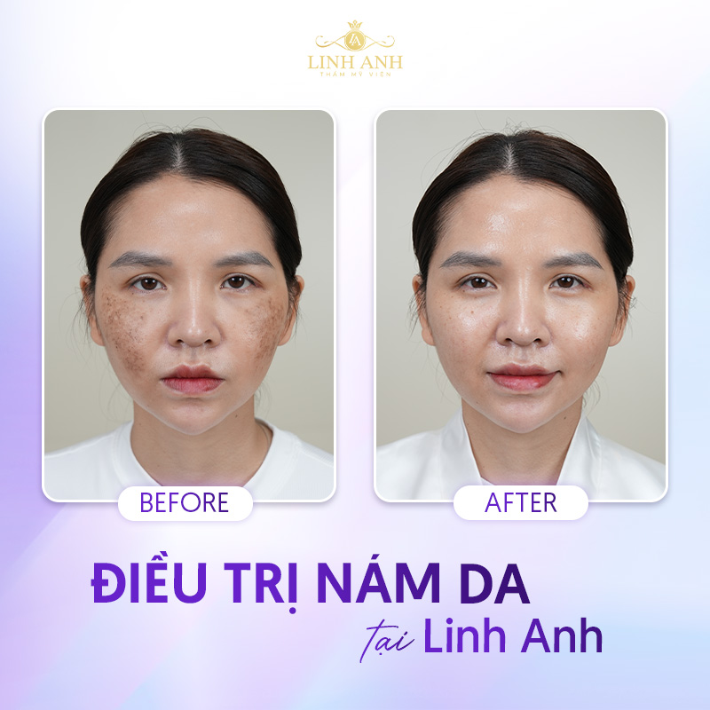top những thẩm mỹ viện uy tín tại tphcm