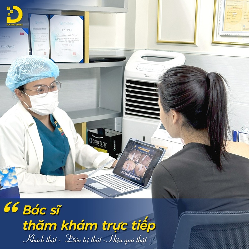 trị sẹo rỗ ở PKDL Dr. Choice Clinic