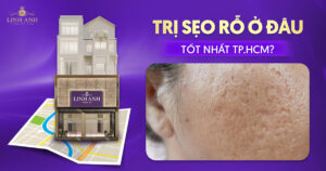 trị sẹo rỗ ở đâu tốt nhất tphcm