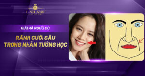 Tướng người có rãnh cười sâu
