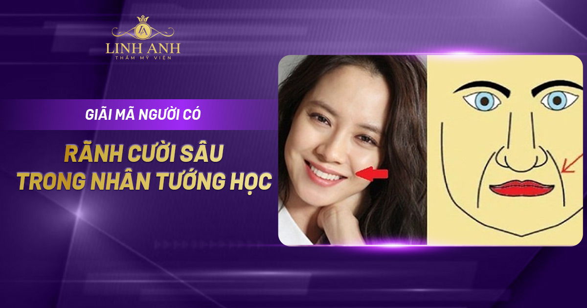 Tướng người có rãnh cười sâu là tốt hay xấu trong nhân tướng học?