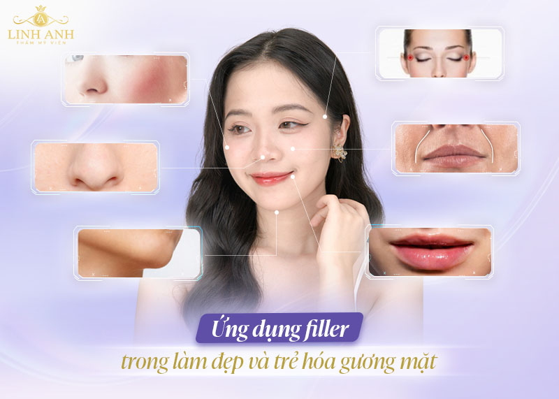 Ứng dụng của filler trong thẩm mỹ làm đẹp