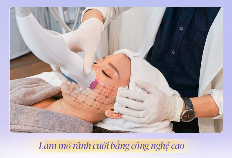 Xoá rãnh cười bằng cách nào