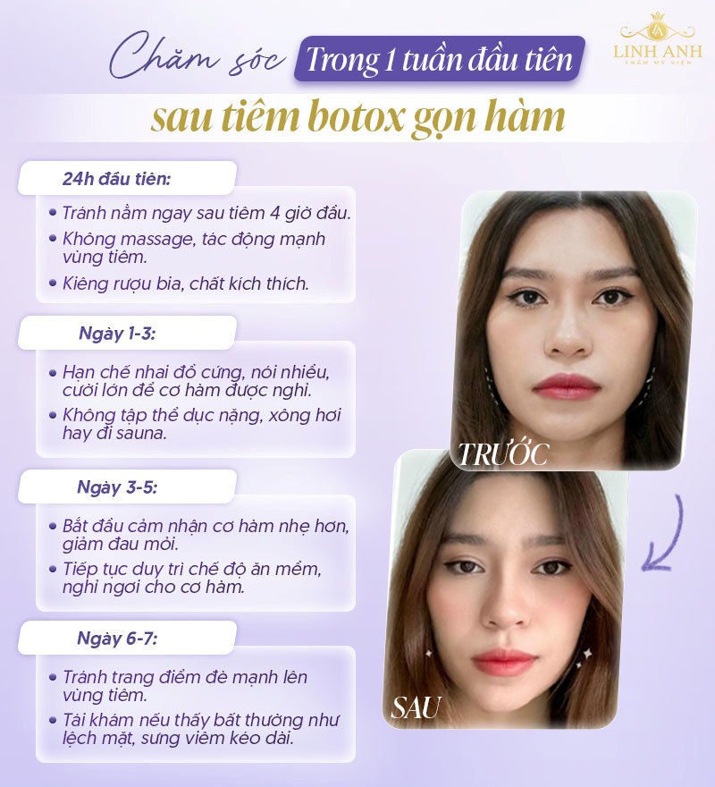 1 Tuần đầu tiên sau tiêm botox gọn hàm