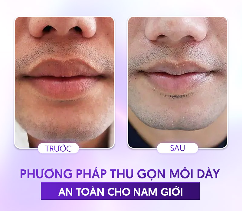 Đặc điểm của đàn ông môi dày