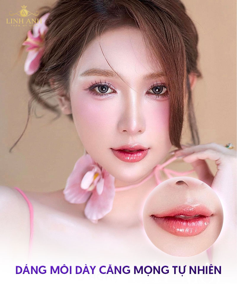 môi dày có đẹp không