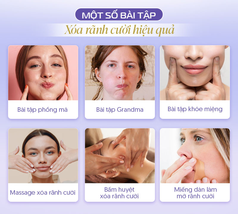 Các bài tập giảm rãnh cười