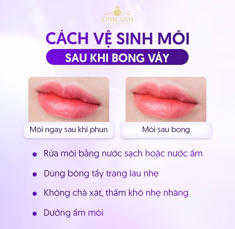 cách chăm sóc môi phun sau khi bong