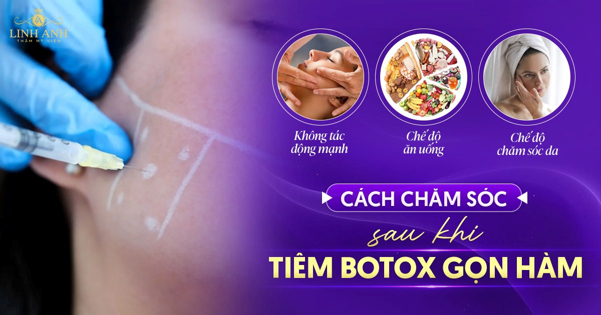 [Bác sĩ khuyến nghị] Cách chăm sóc sau khi tiêm botox gọn hàm