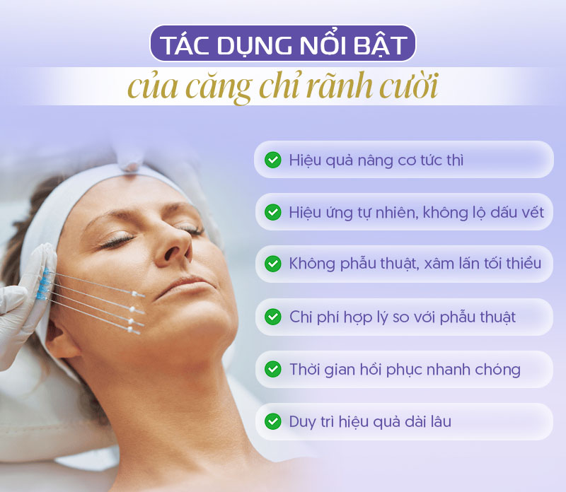 Căng chỉ làm đầy rãnh cười