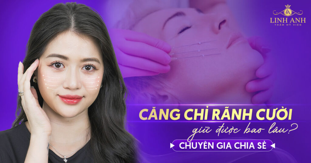 Căng chỉ rãnh cười