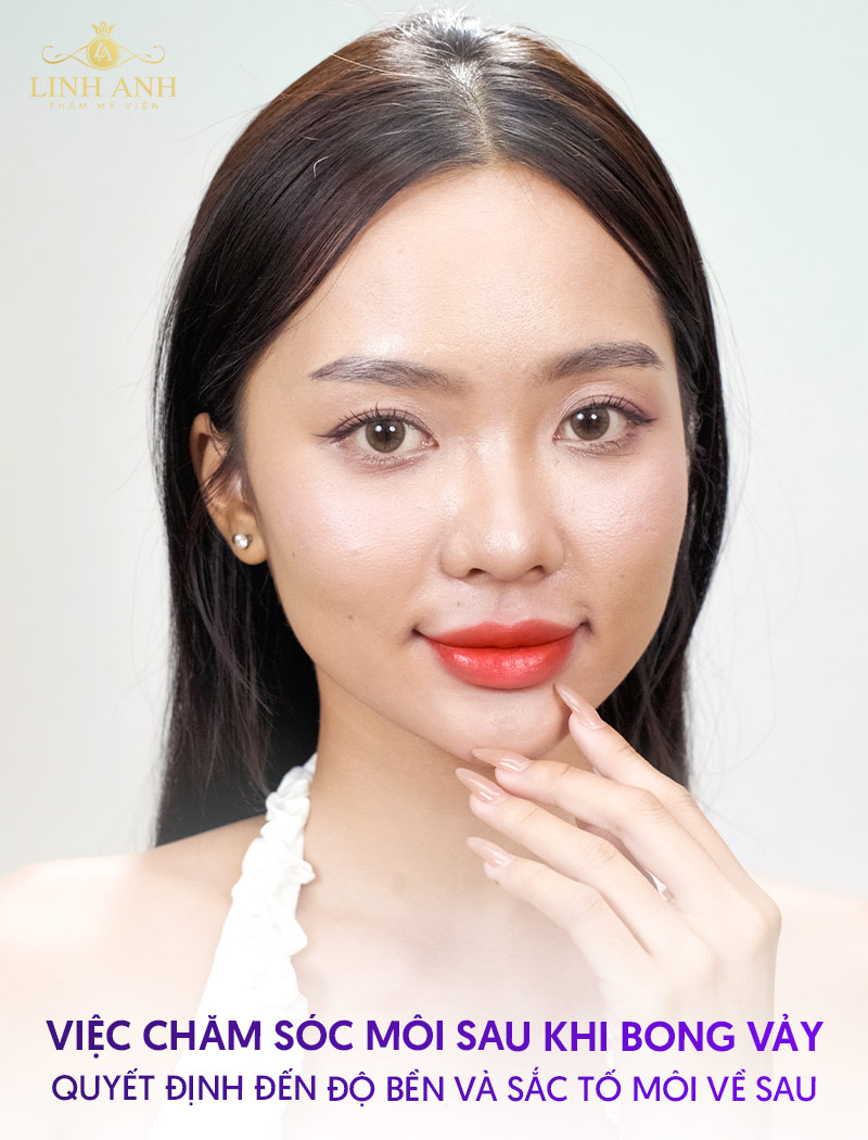 chăm sóc môi sau bong