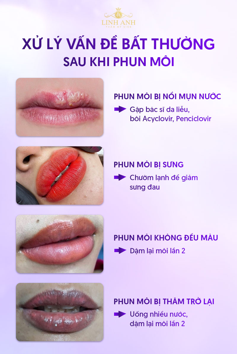 chăm sóc sau khi phun môi chăm sóc sau khi phun môi