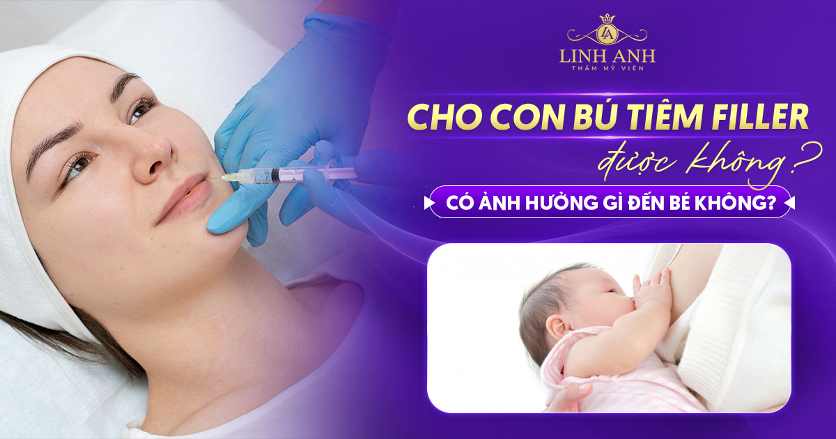 Cho con bú tiêm filler được không? có ảnh hưởng đến sữa mẹ?